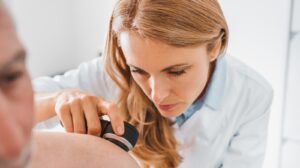 Nevus Birthmark: What It Means And Why Some People Have It Removed - Health Digest